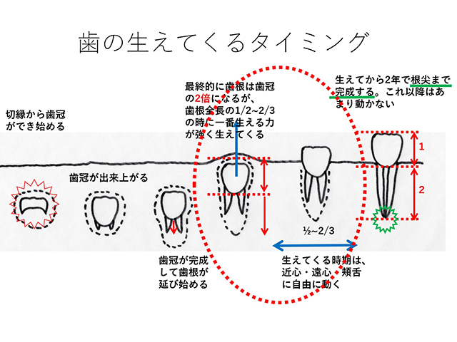 「歯列矯正」と「咬合誘導」