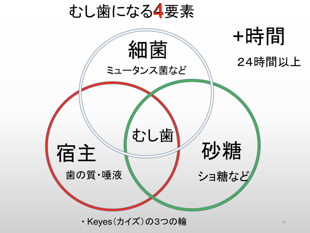 虫歯