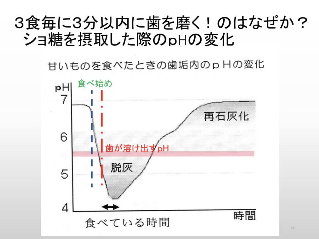 むし歯