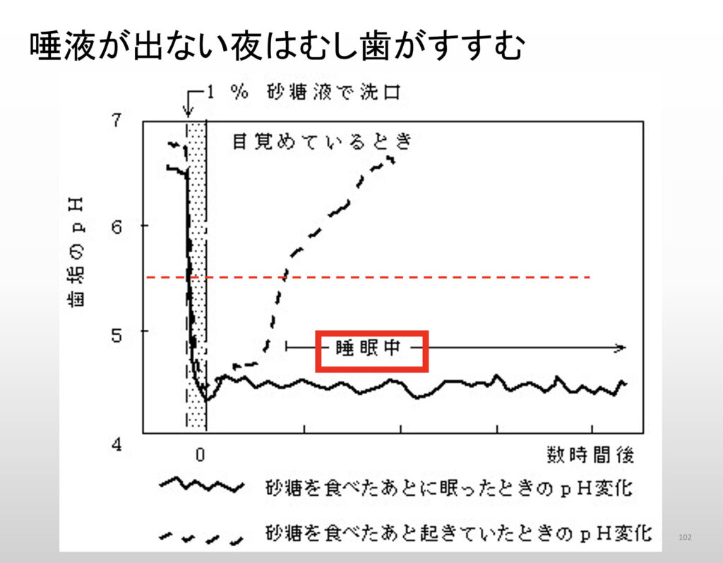 むし歯が進む