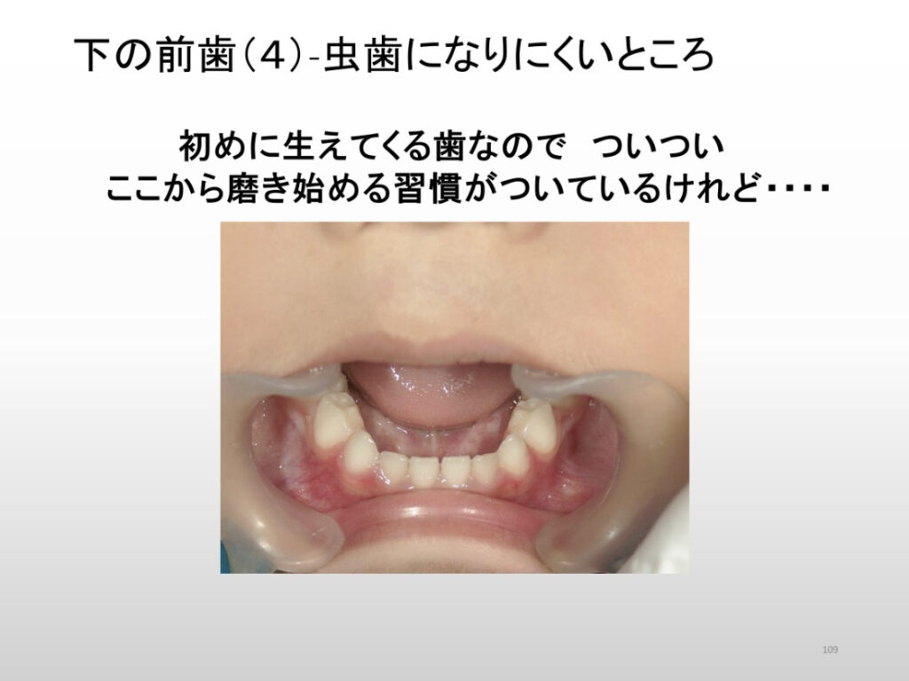 歯磨き