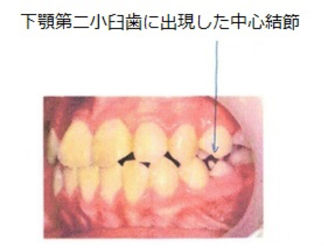 画像に alt 属性が指定されていません。ファイル名: fig1.jpg